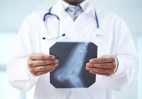 רופא מחזיק צילום רנטגן אורטופדי